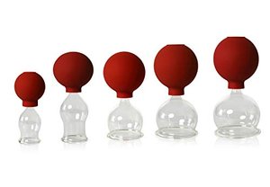 5er Schröpfglas-Set mit Ball zum professionellen, medizinischen, feuerlosen Schröpfen