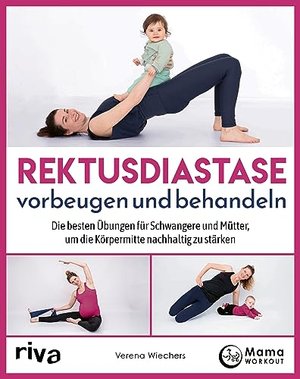 Rektusdiastase vorbeugen und behandeln